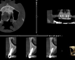 PI final (2ans) PI final (2ans)