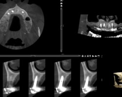 PI initial PI initial